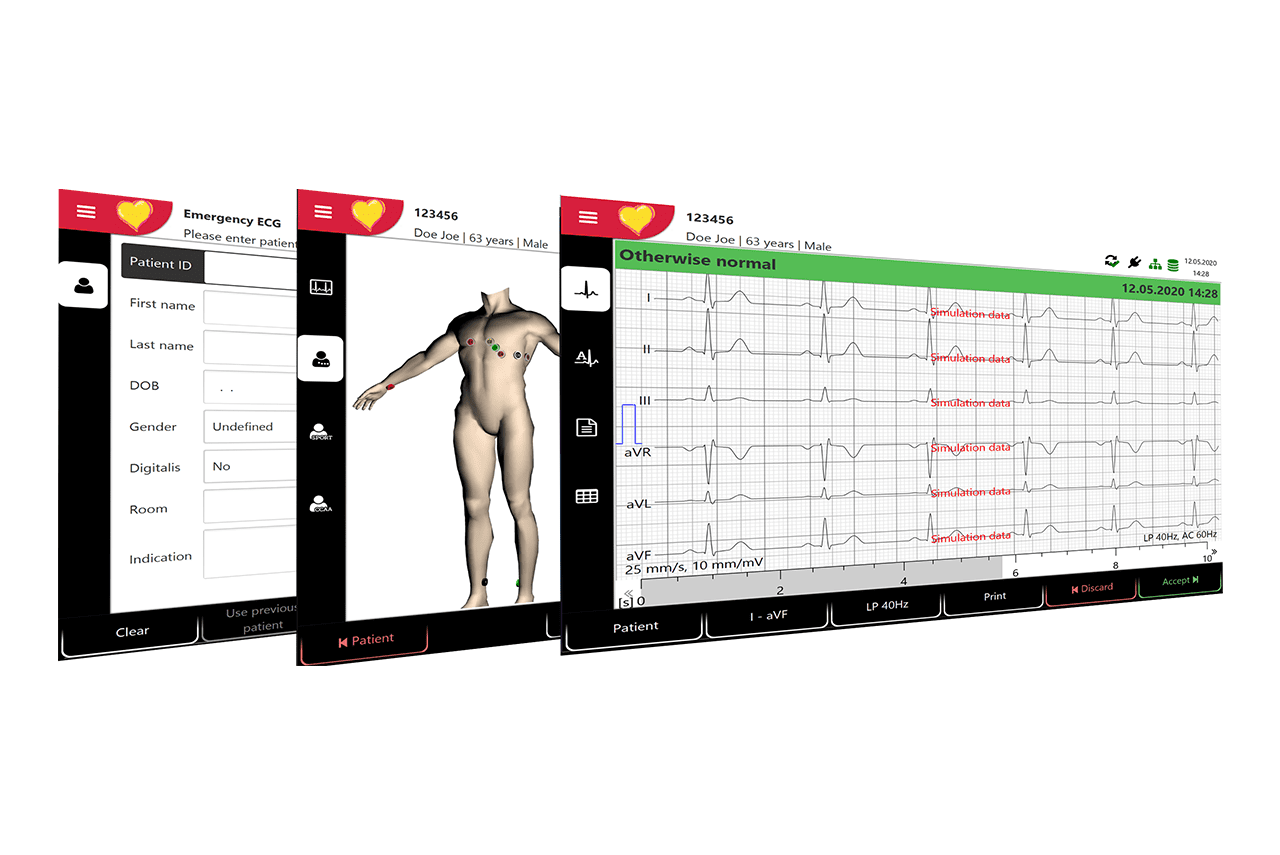 Schiller Cardiovit AT-102 G2 with Connectivity Kit (0A.108000+DICOM/HL7/PDQ)