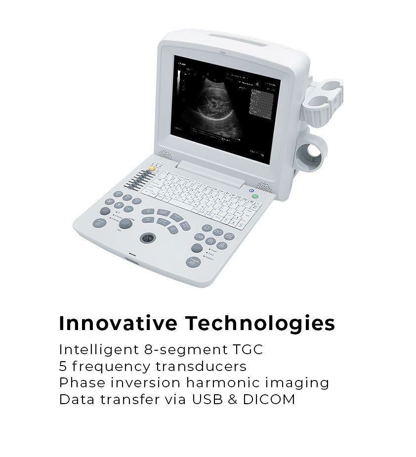 EdanUSA DUS60 Digital Ultrasonic Diagnostic Imaging System