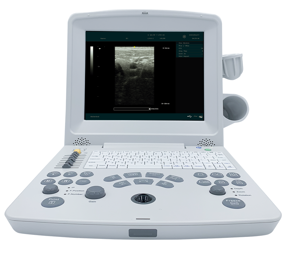 EdanUSA DUS60 Digital Ultrasonic Diagnostic Imaging System