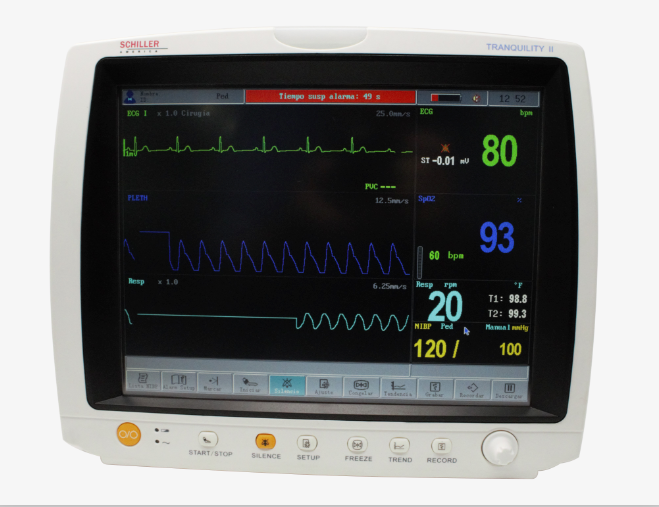 Schiller Tranquility II 12.1" Touchscreen Multiparameter Patient Monitor with ETCO2 ISA Side Stream Analyzer, CO2, N2O, 5AA, AA ID (0-750000ET-601)