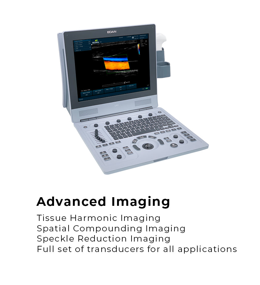 EdanUSA U60 Veterinary Ultrasound System