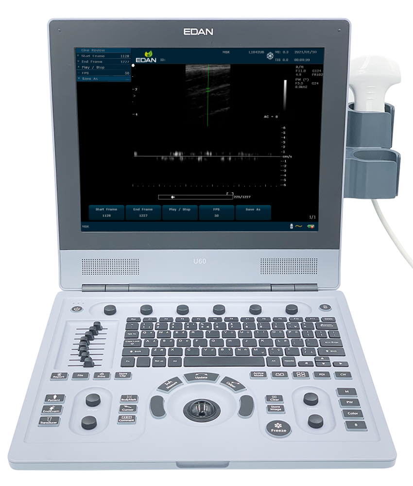 EdanUSA U60 Veterinary Ultrasound System