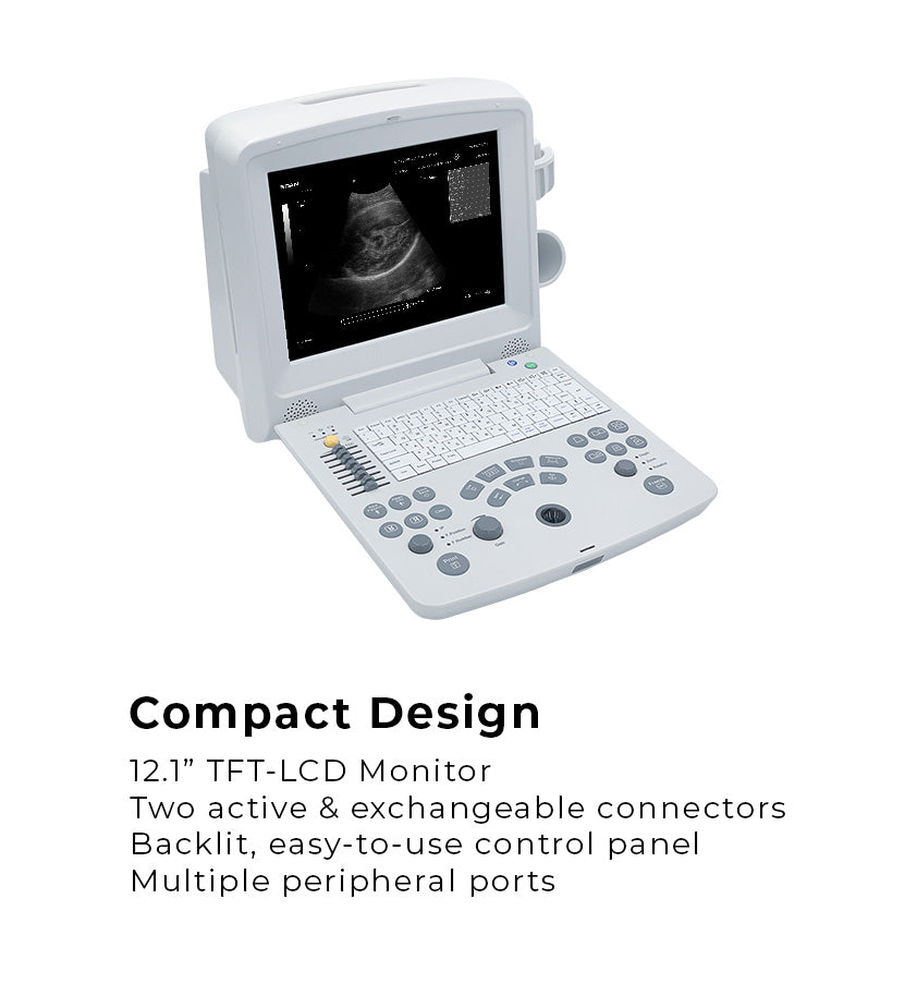 EdanUSA DUS60 Digital Ultrasonic Diagnostic Imaging System